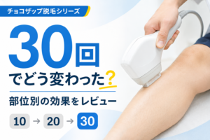 【チョコザップ】セルフ脱毛30回やったのでレビュー|効果はあるのか?部位別の変化まとめ